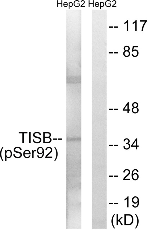 Phospho-ZFP36L1 (Ser92) Antibody in Western Blot (WB)