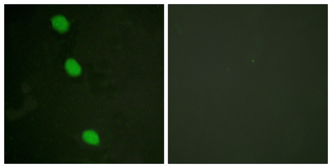 Phospho-CaMKIV (Thr196, Thr200) Antibody in Immunocytochemistry (ICC/IF)