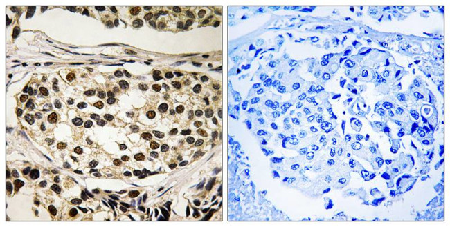Phospho-Cyclin C (Ser275) Antibody in Immunohistochemistry (Paraffin) (IHC (P))