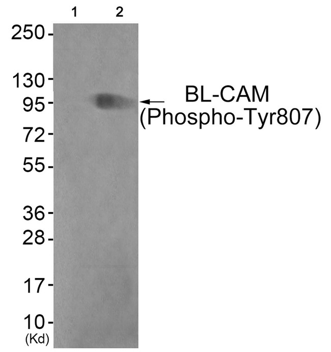 Phospho-CD22 (Tyr807) Antibody in Western Blot (WB)