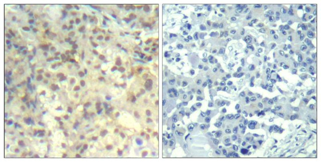 Phospho-Cofilin (Tyr139) Antibody in Immunohistochemistry (Paraffin) (IHC (P))
