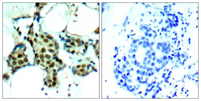 Phospho-p38 MAPK (Tyr182) Antibody in Immunohistochemistry (Paraffin) (IHC (P))