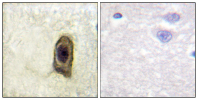 Phospho-CSF1R (Tyr561) Antibody in Immunohistochemistry (Paraffin) (IHC (P))