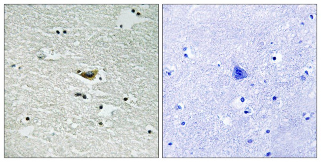 Phospho-CK1 alpha (Tyr294) Antibody in Immunohistochemistry (Paraffin) (IHC (P))
