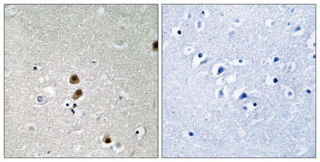 Phospho-CtBP1 (Ser422) Antibody in Immunohistochemistry (Paraffin) (IHC (P))