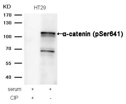 Phospho-alpha Catenin (Ser641) Antibody in Western Blot (WB)