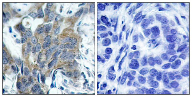 Phospho-beta Catenin (Ser33) Antibody in Immunohistochemistry (Paraffin) (IHC (P))