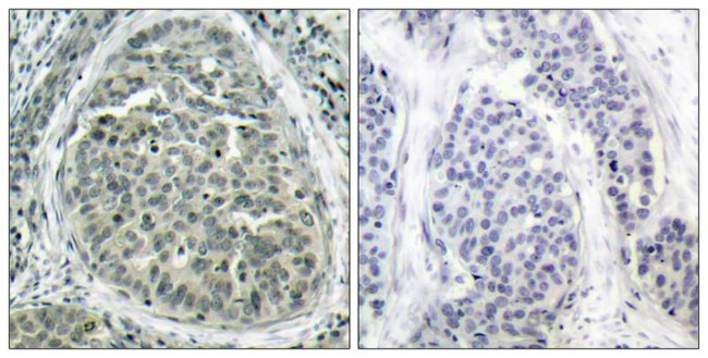 Phospho-beta Catenin (Ser37) Antibody in Immunohistochemistry (Paraffin) (IHC (P))