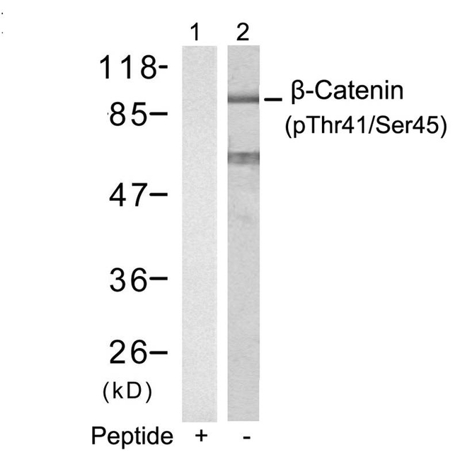 Phospho-beta Catenin (Thr41, Ser45) Antibody in Western Blot (WB)