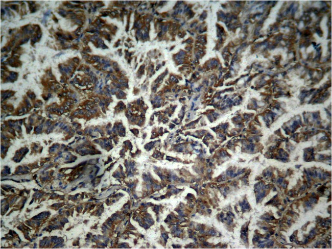 Phospho-beta Catenin (Tyr333) Antibody in Immunohistochemistry (Paraffin) (IHC (P))