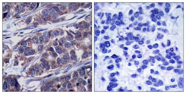 Phospho-DOK1 (Tyr362) Antibody in Immunohistochemistry (Paraffin) (IHC (P))