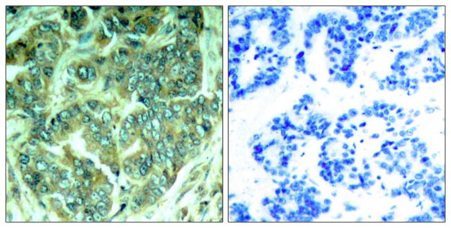 Phospho-DOK1 (Tyr398) Antibody in Immunohistochemistry (Paraffin) (IHC (P))