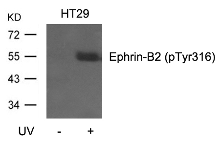 Phospho-Ephrin B2 (Tyr316) Antibody in Western Blot (WB)