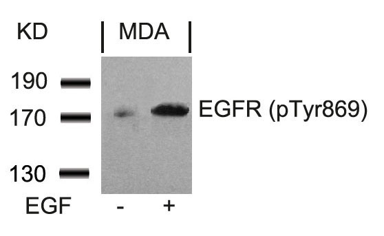Phospho-EGFR (Tyr869) Antibody in Western Blot (WB)