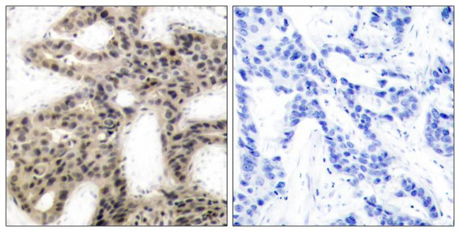 Phospho-4EBP1 (Thr46) Antibody in Immunohistochemistry (Paraffin) (IHC (P))