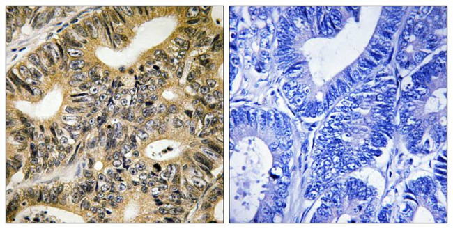 Phospho-4EBP1 (Thr70) Antibody in Immunohistochemistry (Paraffin) (IHC (P))