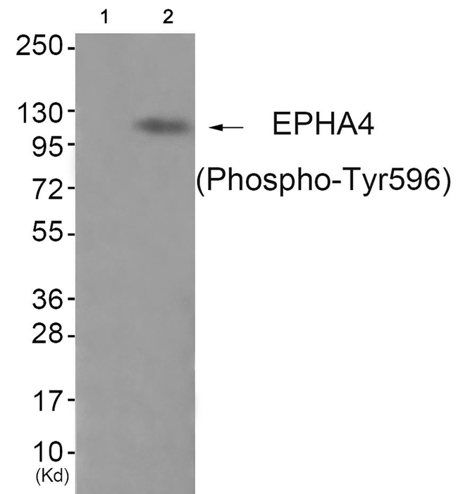 Phospho-EphA4 (Tyr596) Antibody in Western Blot (WB)