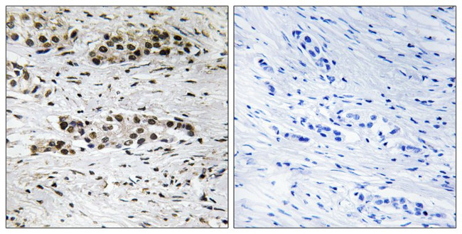 Phospho-Estrogen Receptor alpha (Ser102) Antibody in Immunohistochemistry (Paraffin) (IHC (P))