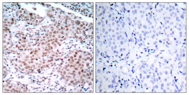 Phospho-Estrogen Receptor alpha (Ser104) Antibody in Immunohistochemistry (Paraffin) (IHC (P))