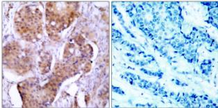 Phospho-Estrogen Receptor alpha (Ser106) Antibody in Immunohistochemistry (Paraffin) (IHC (P))