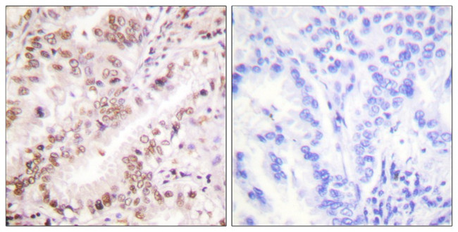 Phospho-Estrogen Receptor alpha (Tyr537) Antibody in Immunohistochemistry (Paraffin) (IHC (P))
