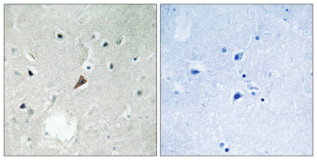 Phospho-PYK2 (Tyr579) Antibody in Immunohistochemistry (Paraffin) (IHC (P))