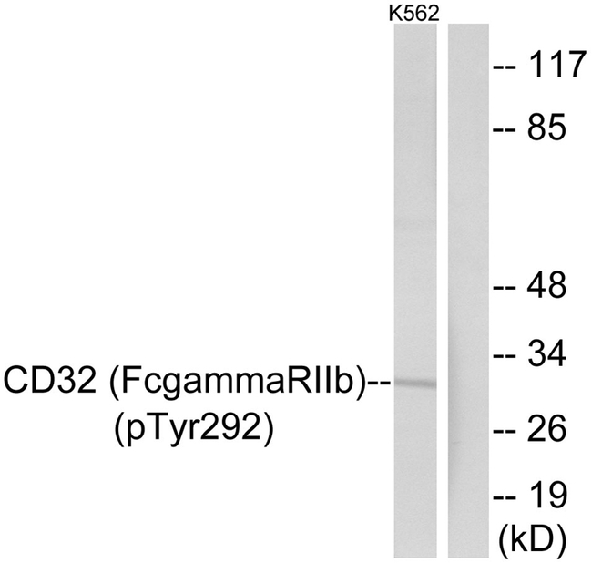 Phospho-FCGR2B (Tyr292) Antibody in Western Blot (WB)