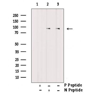 Phospho-FGFR4 (Tyr642) Antibody in Western Blot (WB)