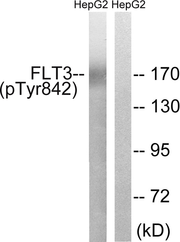 Phospho-FLT3 (Tyr842) Antibody in Western Blot (WB)