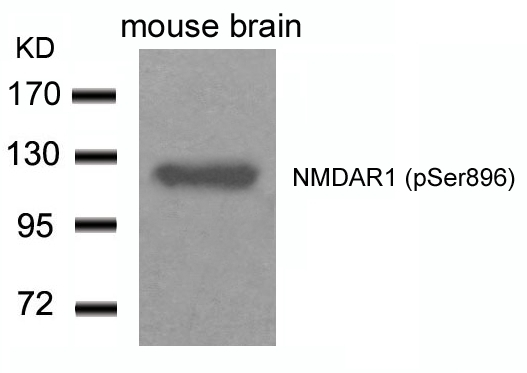 Phospho-NMDAR1 (Ser896) Antibody in Western Blot (WB)