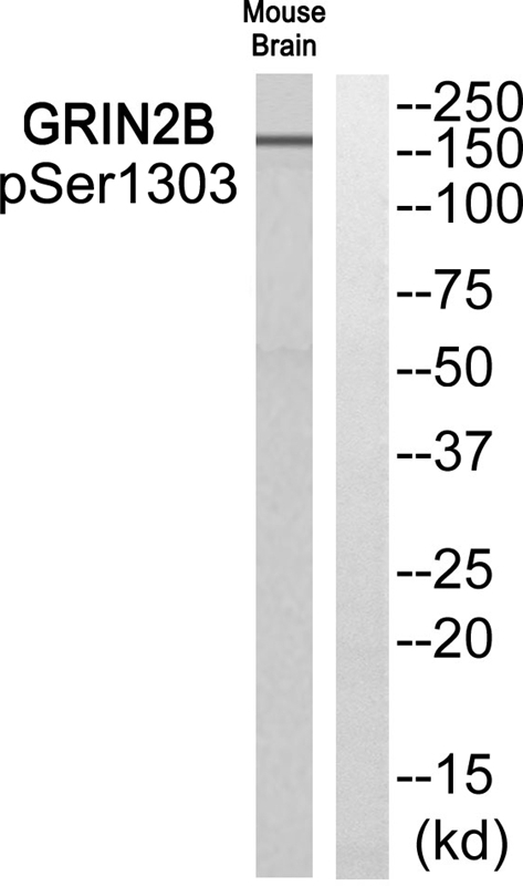 Phospho-NMDAR2B (Ser1303) Antibody in Western Blot (WB)