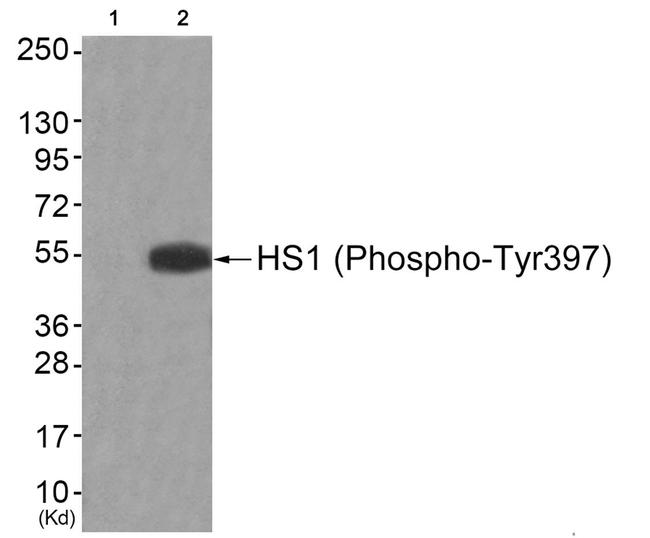 Phospho-HCLS1 (Tyr397) Antibody in Western Blot (WB)