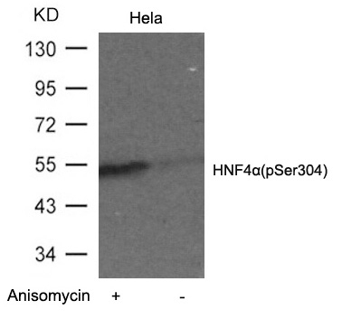 Phospho-HNF4A (Ser304) Antibody in Western Blot (WB)