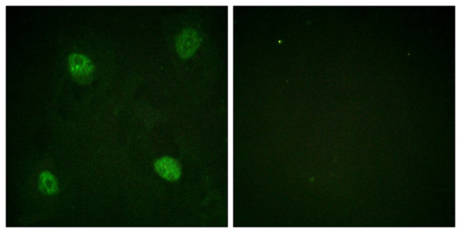 Phospho-hnRNP D (Ser83) Antibody in Immunocytochemistry (ICC/IF)