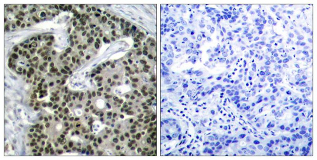 Phospho-HSF1 (Ser303) Antibody in Immunohistochemistry (Paraffin) (IHC (P))
