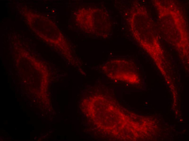 Phospho-HSF1 (Ser307) Antibody in Immunocytochemistry (ICC/IF)
