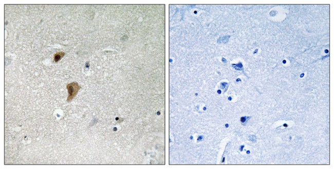 Phospho-HSF1 (Thr142) Antibody in Immunohistochemistry (Paraffin) (IHC (P))