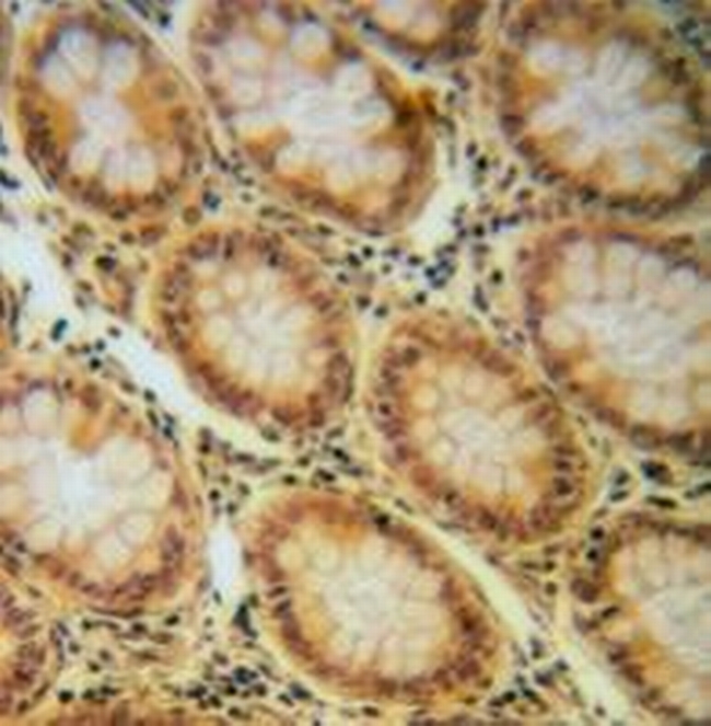 Phospho-IGF1R beta (Tyr1165, Tyr1166) Antibody in Immunohistochemistry (Paraffin) (IHC (P))