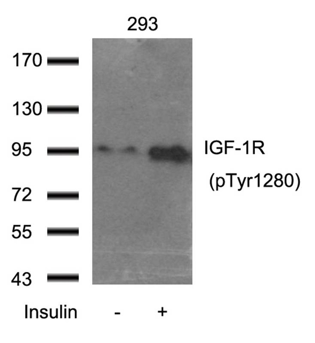 Phospho-IGF1R beta (Tyr1280) Antibody in Western Blot (WB)