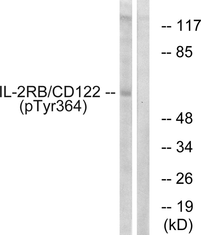 Phospho-CD122 (Tyr364) Antibody in Western Blot (WB)