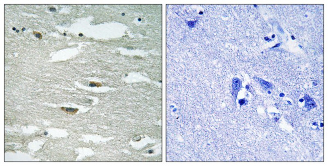 Phospho-ILK (Ser246) Antibody in Immunohistochemistry (Paraffin) (IHC (P))