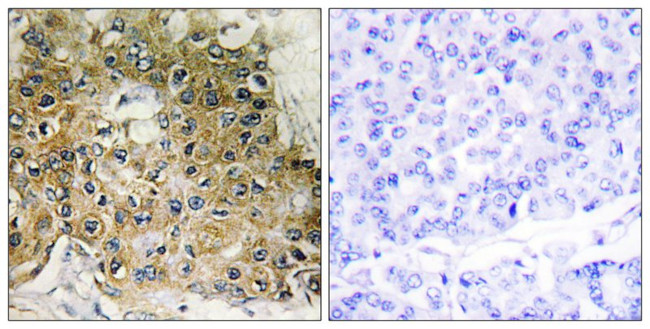Phospho-ITGB1 (Thr789) Antibody in Immunohistochemistry (Paraffin) (IHC (P))