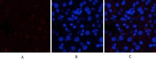 Phospho-JAK1 (Tyr1034) Antibody in Immunohistochemistry (Paraffin) (IHC (P))