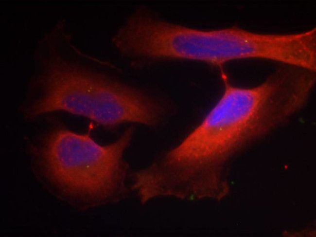 Phospho-Cytokeratin 8 (Ser74) Antibody in Immunocytochemistry (ICC/IF)