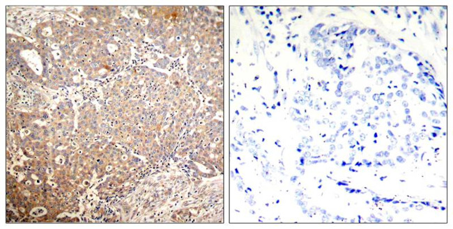 Phospho-Cytokeratin 18 (Ser33) Antibody in Immunohistochemistry (Paraffin) (IHC (P))