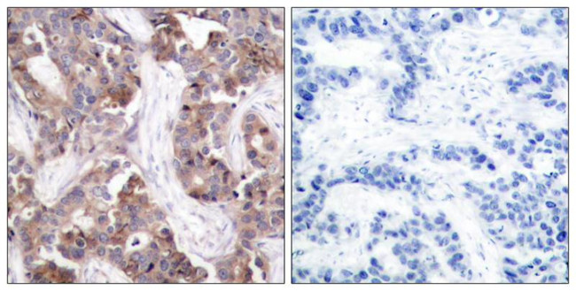 Phospho-Stathmin 1 (Ser25) Antibody in Immunohistochemistry (Paraffin) (IHC (P))