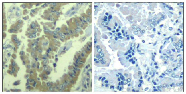 Phospho-MARCKS (Ser170) Antibody in Immunohistochemistry (Paraffin) (IHC (P))