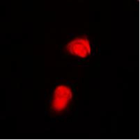 Phospho-SMAD2 (Thr220) Antibody in Immunocytochemistry (ICC/IF)