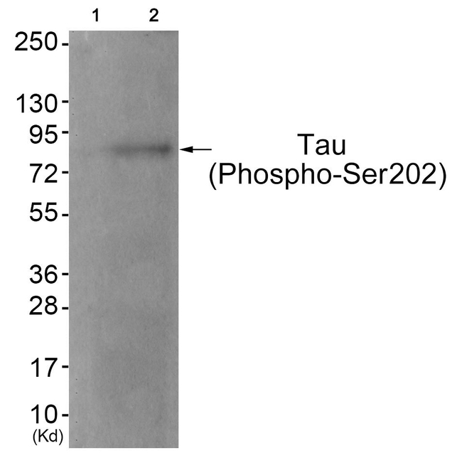 Phospho-Tau (Ser202) Antibody in Western Blot (WB)