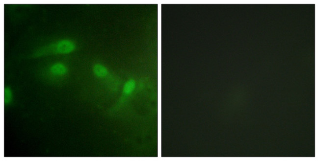 Phospho-MDM2 (Ser186, Ser188) Antibody in Immunocytochemistry (ICC/IF)